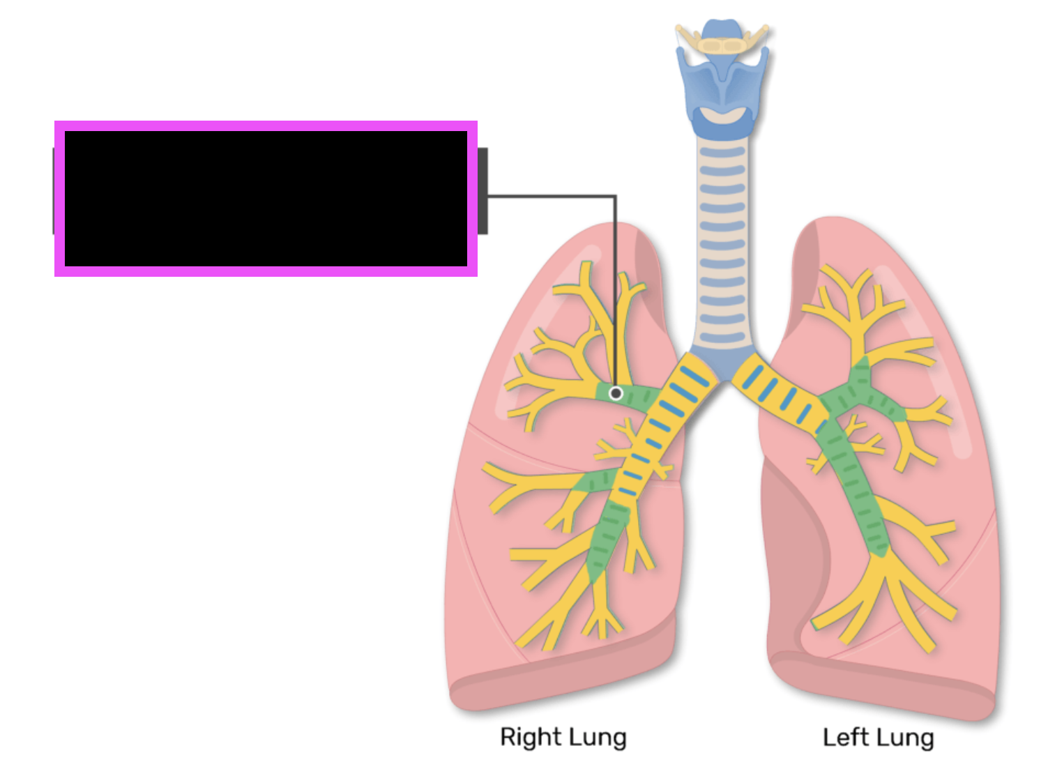 term image