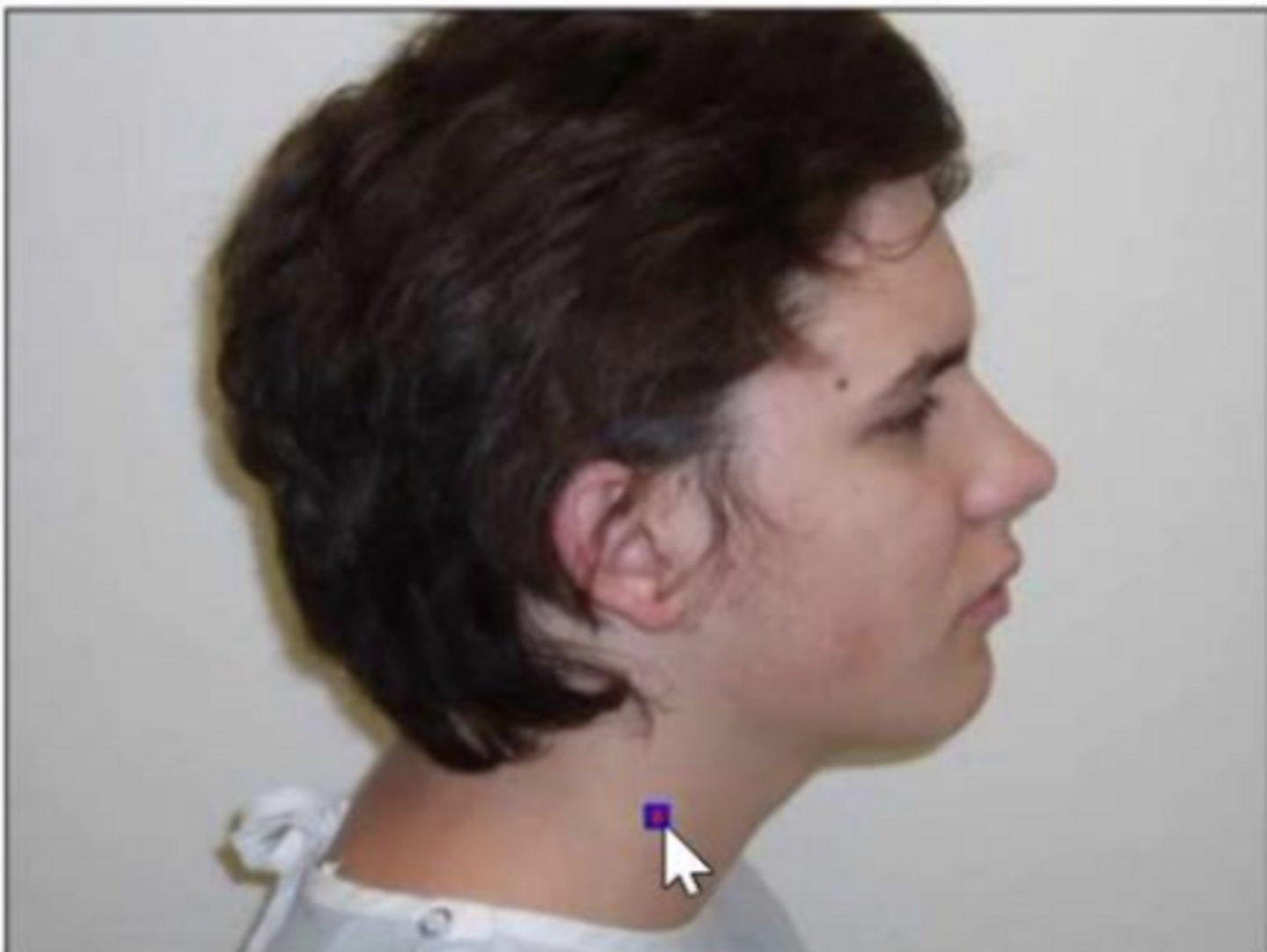 <p>lower half of the neck</p>