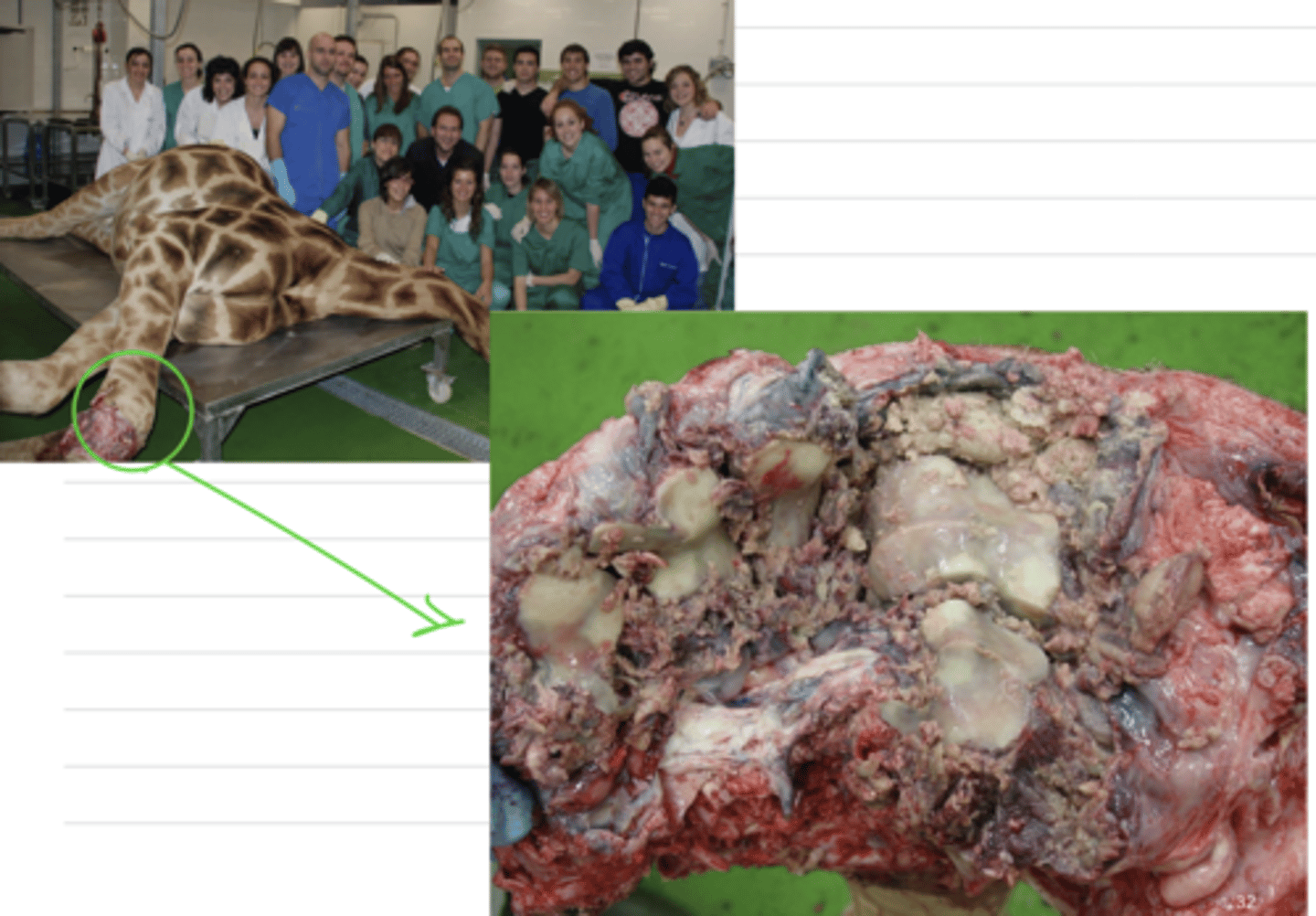<p>lesion produced when a tissue with coagulative necrosis is further degraded by saprophytic bacteria that have contaminated it from the environment. the bacteria cause putrifaction of the tissue, leaving a soft, moist, red-brown-black tissue.</p>