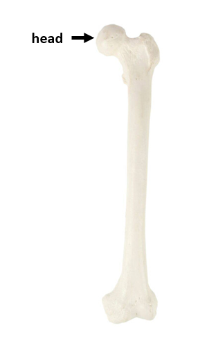 <p>What bone is this?</p>