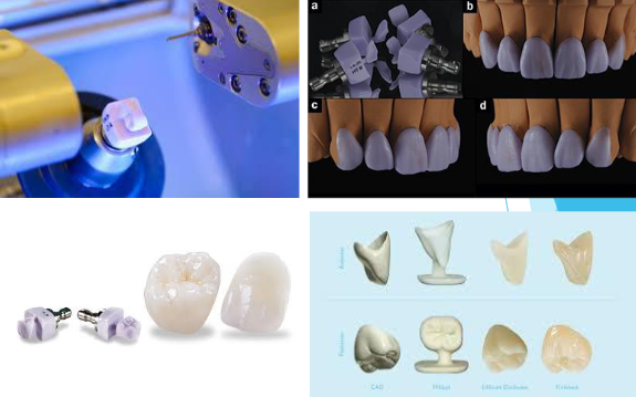 <p><span>Lithium Disilicate can be </span></p>