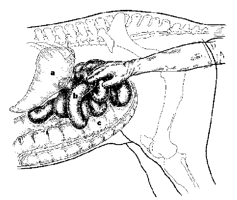 <p>small intestine distension</p>