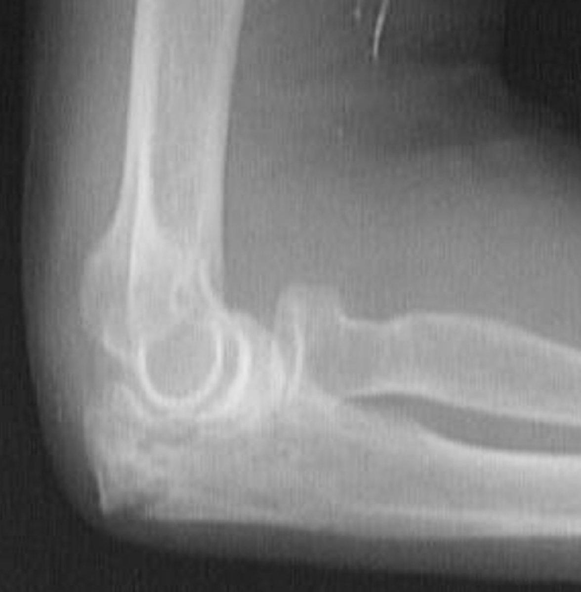 <p>What is the issue?</p>