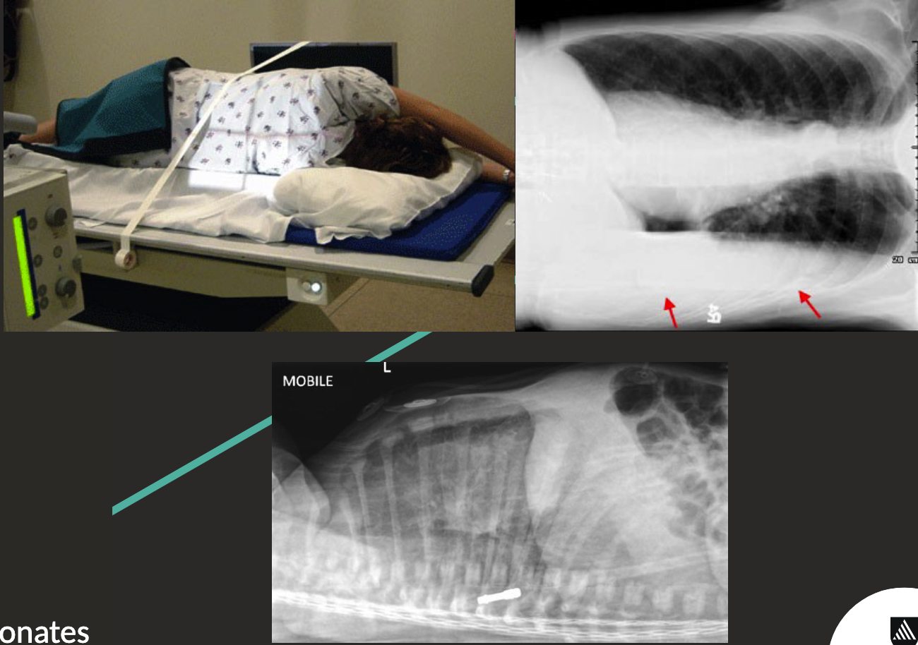 <ul><li><p>Patient lying on their side.</p></li><li><p>Will show like a PA/AP projection.</p></li><li><p>Side down for pleural effusion.</p></li><li><p>Side up for pneumothorax.</p></li><li><p>Can be lateral (top left pictures) or supine (bottom).</p></li></ul><p></p>