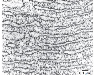 <p>What function is performed by the part of the cell shown in the electron micrograph?</p>