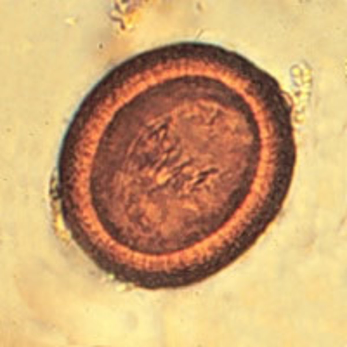 <p>30-45um</p><p>Round</p><p>Thick striated dark brown shell</p>