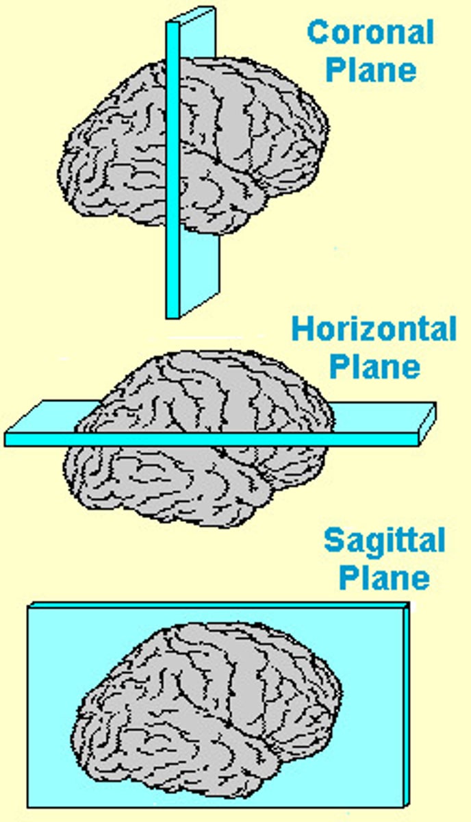 <p>1. Coronal/Cross Section<br>2. Sagittal Section<br>3. Horizontal Section</p>