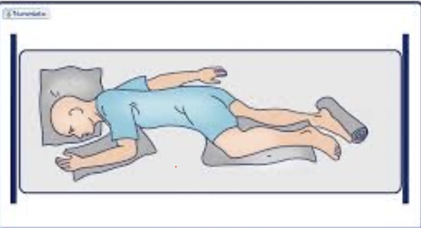 <p>What position can be used to minimize vena cava compression in a pregnant patient?</p>