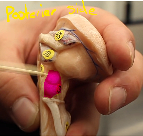 <p>brainstem organization pg.~458</p><p>what is this structure of the midbrain</p>