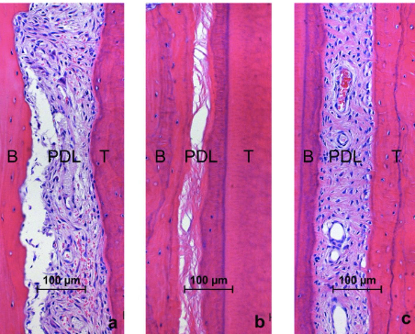 <p>Fibers are not elastic, but elongate with pressure exerted on tooth</p><p>Wavy configuration</p>