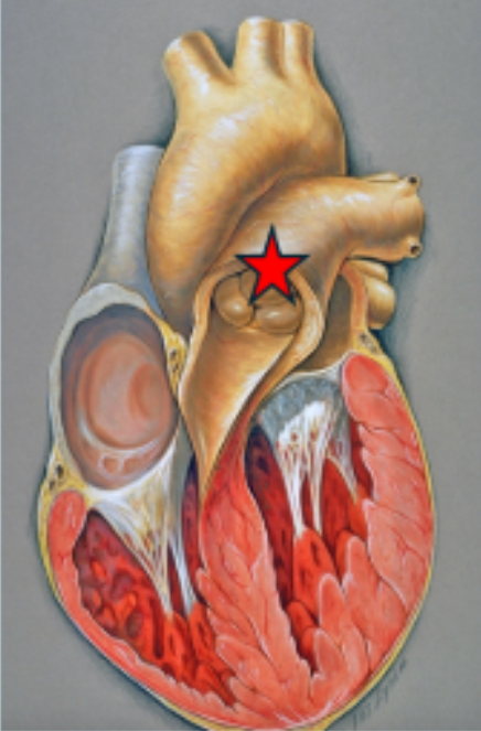 <p>Does oxygenated or deoxygenated blood pass through the heart valve marked with the star?</p>