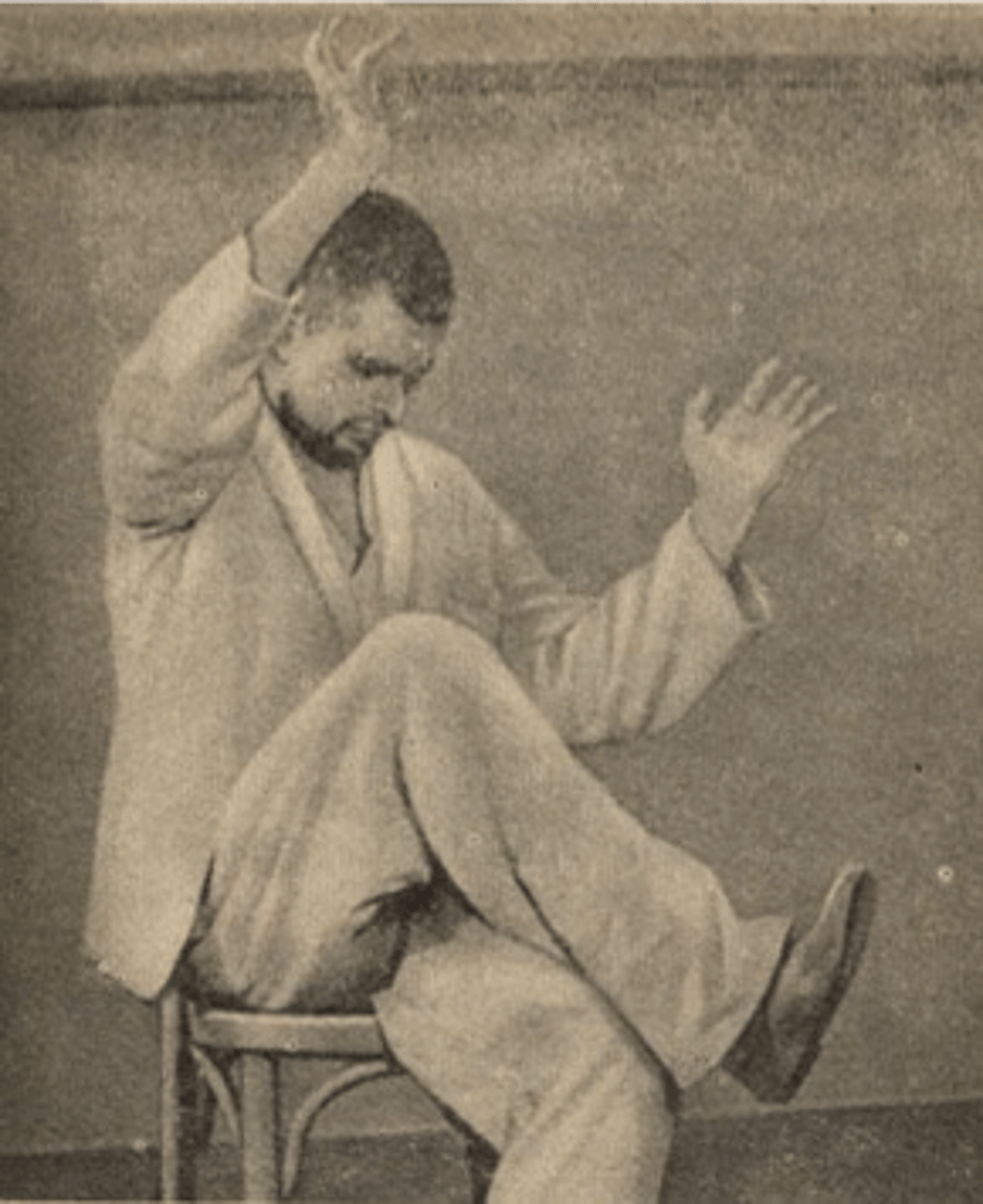 <p>rare, severe depression with disturbances of motor behavior and speech<br>- severe psychomotor retardation; can put them into certain positions they will maintain over a long period of time<br>- they are <b>"cut off from the world"</b></p>