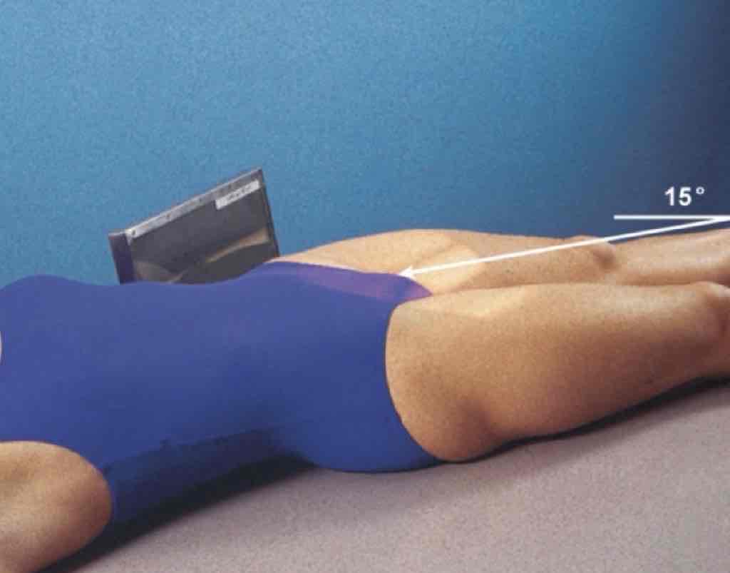 <p>What Projection is this?</p>