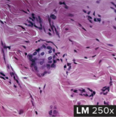 <p><strong>Dense Irregular </strong>Connective Tissue</p><ul><li><p>structure: composed of collagen fibers running in different directions (like storm eye of Jupiter)</p></li><li><p>function: strength capable of withstanding stretching in all directions</p></li><li><p>location: dermis of the skin, outer covering of body tubes, sheaths</p></li></ul><p></p>