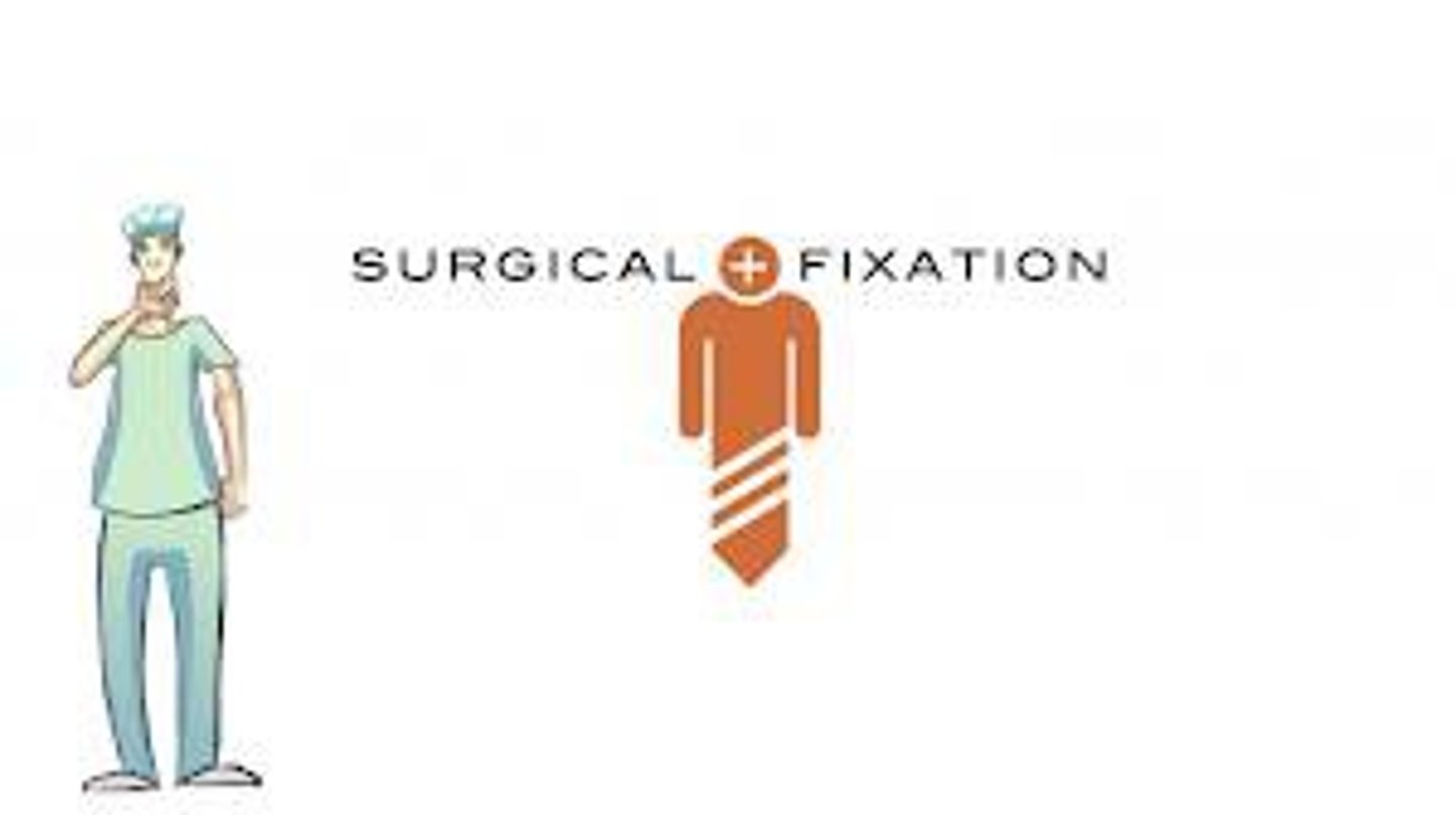 <p>surgical fixation</p>