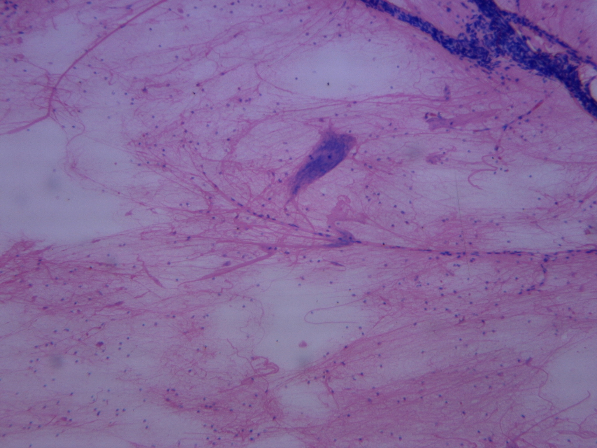 <p>what kind of tissue is this?</p>