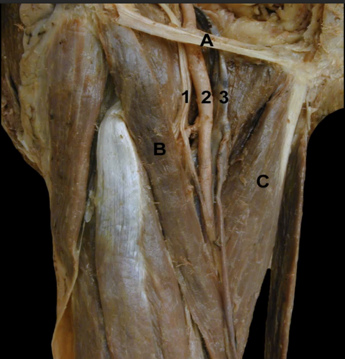 <p>Identify the indicated structures on this <strong>Anterior View </strong>of the Thighs <strong>Femoral Triangle Boarders</strong></p>