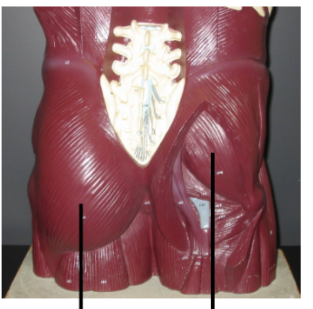 <p>muscle on right</p>
