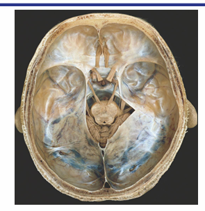 <p>Identify where the transverse sinus, confluence of sinuses and straight sinus would be </p>