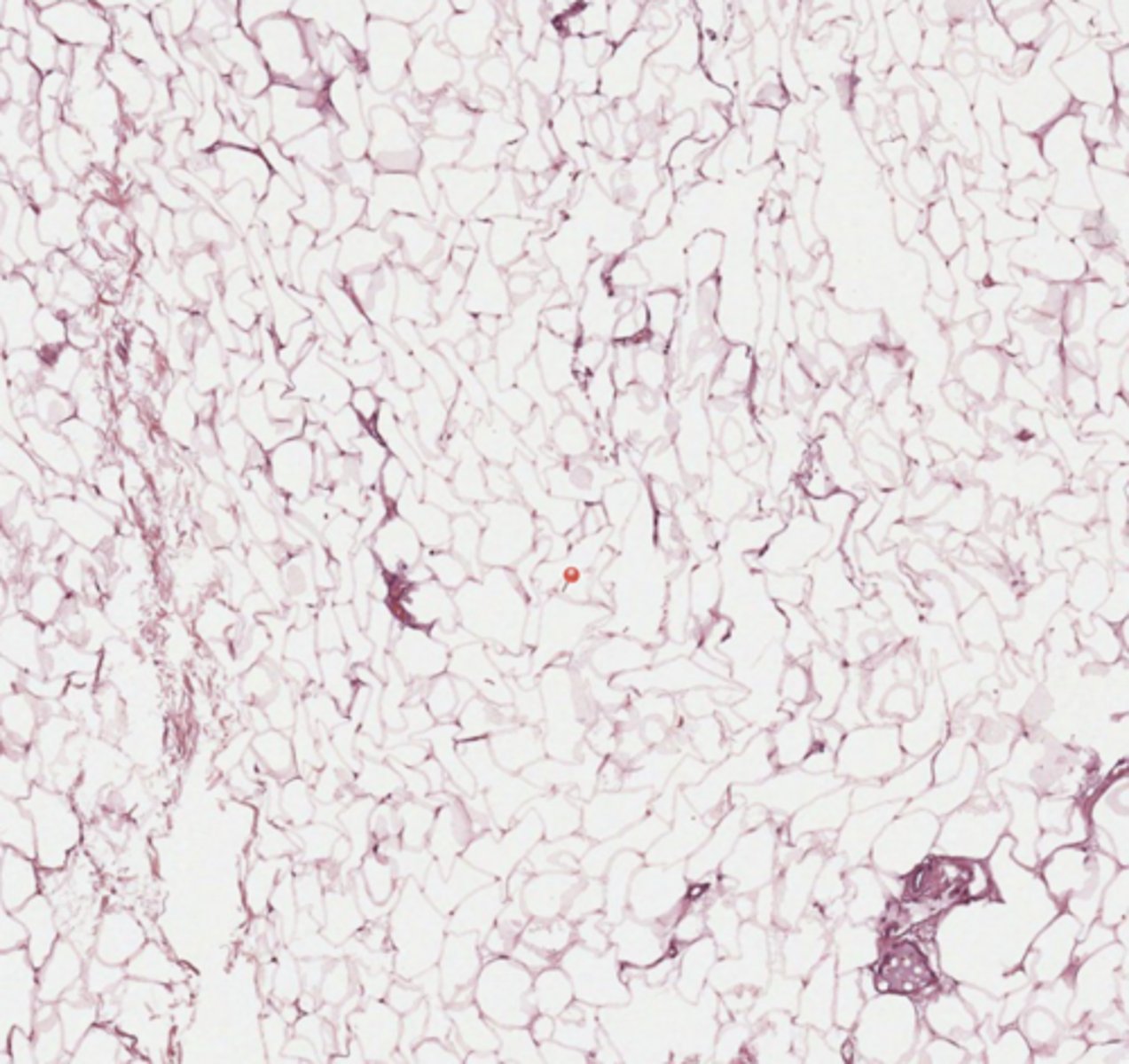 <p>Breast</p>