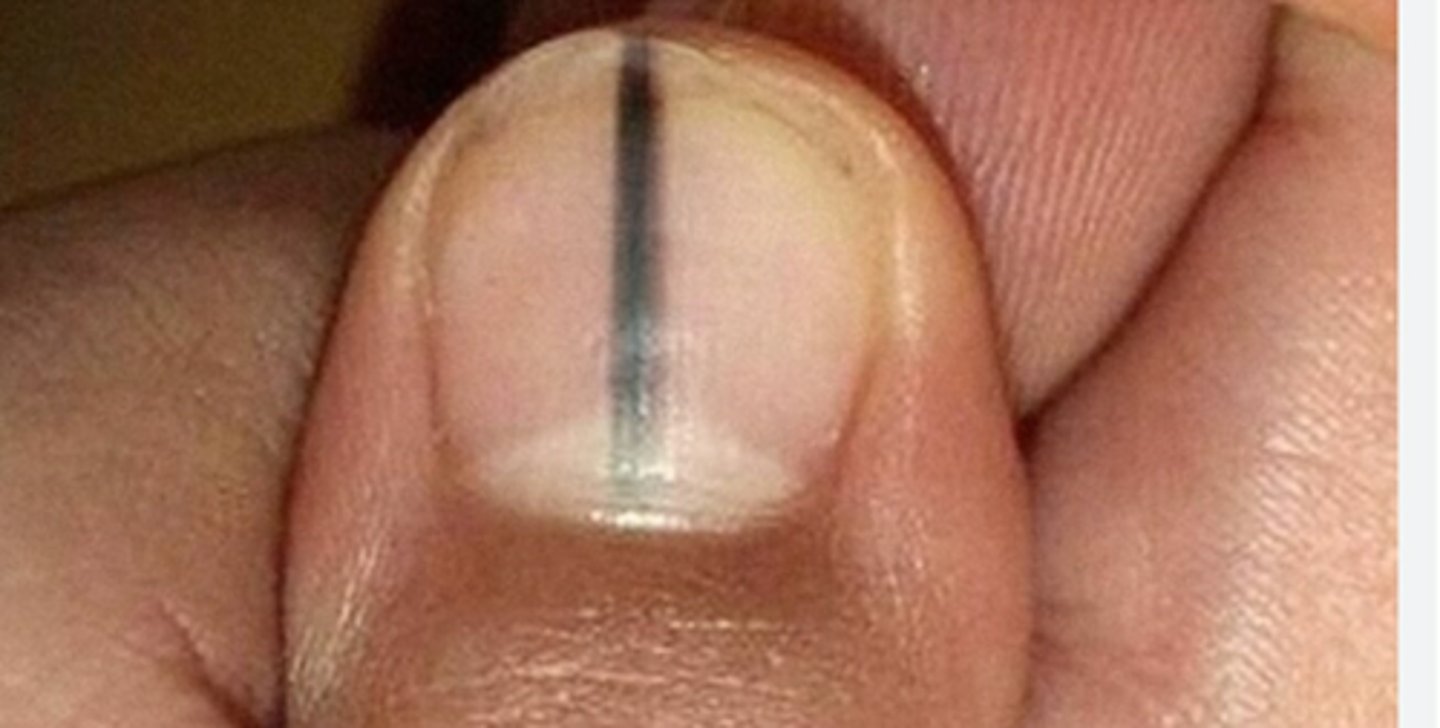 <p>Welk letsel is dit?</p>