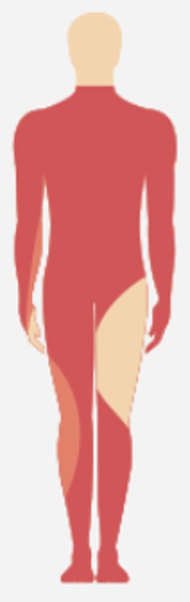 <p>most common neurological level of SCIs</p>