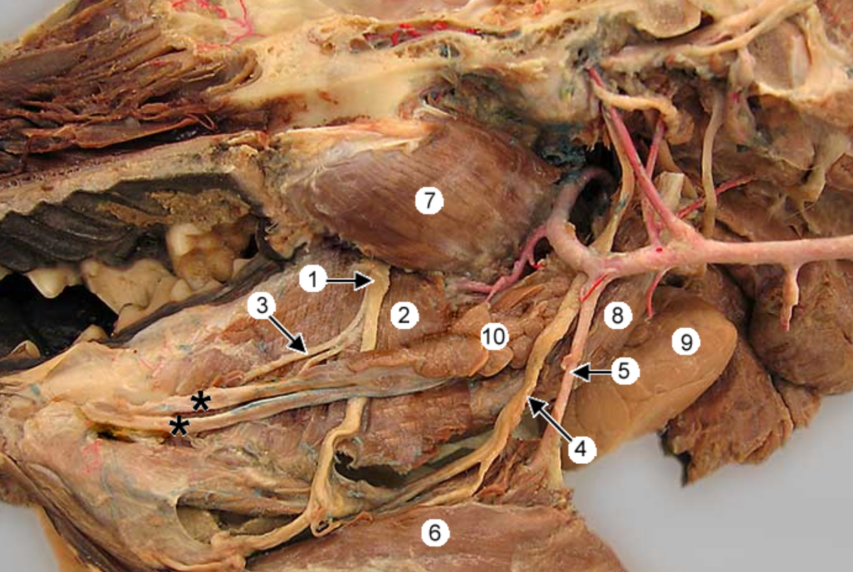 <p>this is an up close image of the head and the tongue is pulled to the side (teeth on left side).</p><p>label 1-9, except 3</p><p>what nerve is right before 1 (behind the muscle 7)</p>