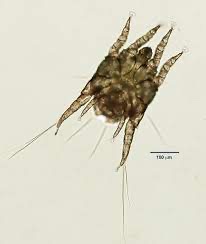 <p>This was found on the ear swab of a cat.</p>