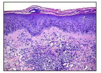 <p>what kind of inflammation is this</p>