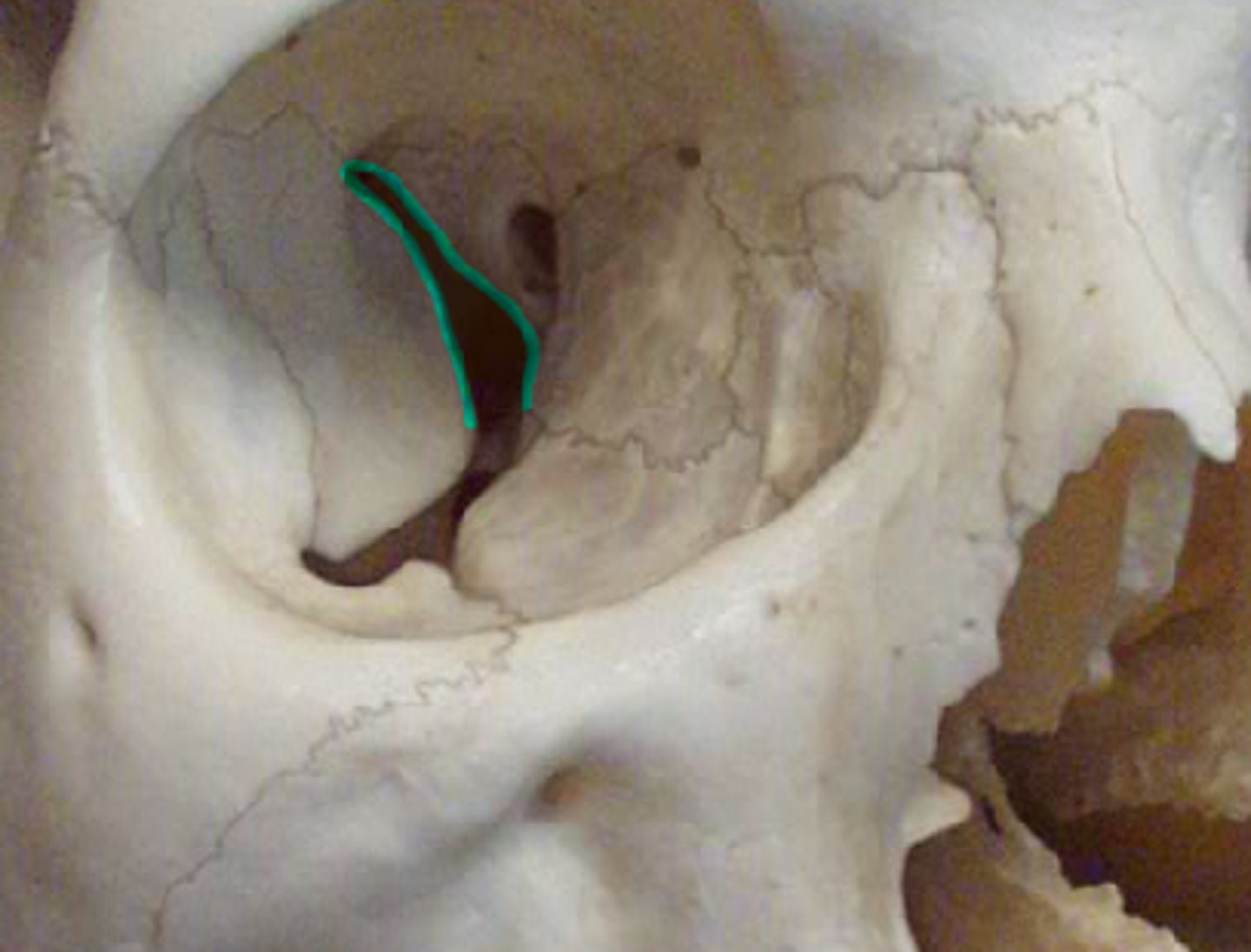<p>Between greater and lesser wing on the sphenoid bone, transmits oculomotor, trochlear, and abducens nerves. Also a branch of opthalmic CN V1</p>