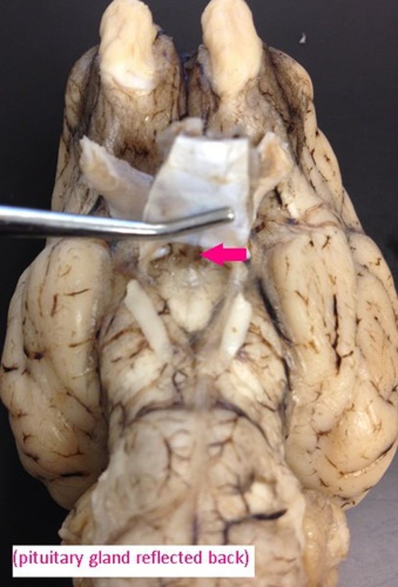 <p>Identify the structure.</p>