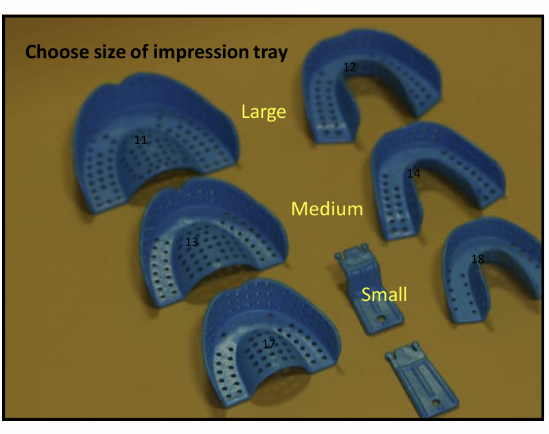 <p>Left and right are used for which arches?</p>