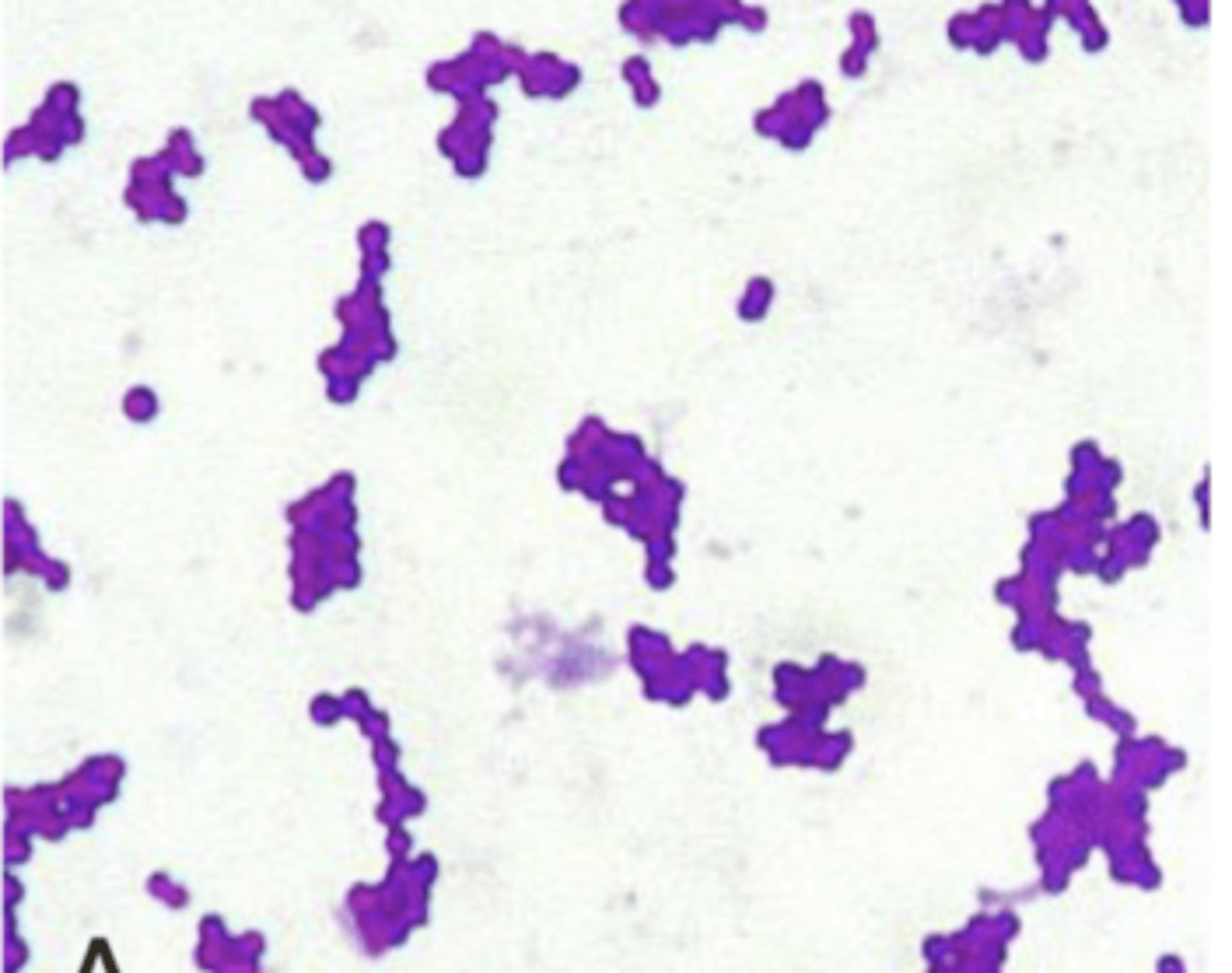 <p>what bacteria is this?</p>