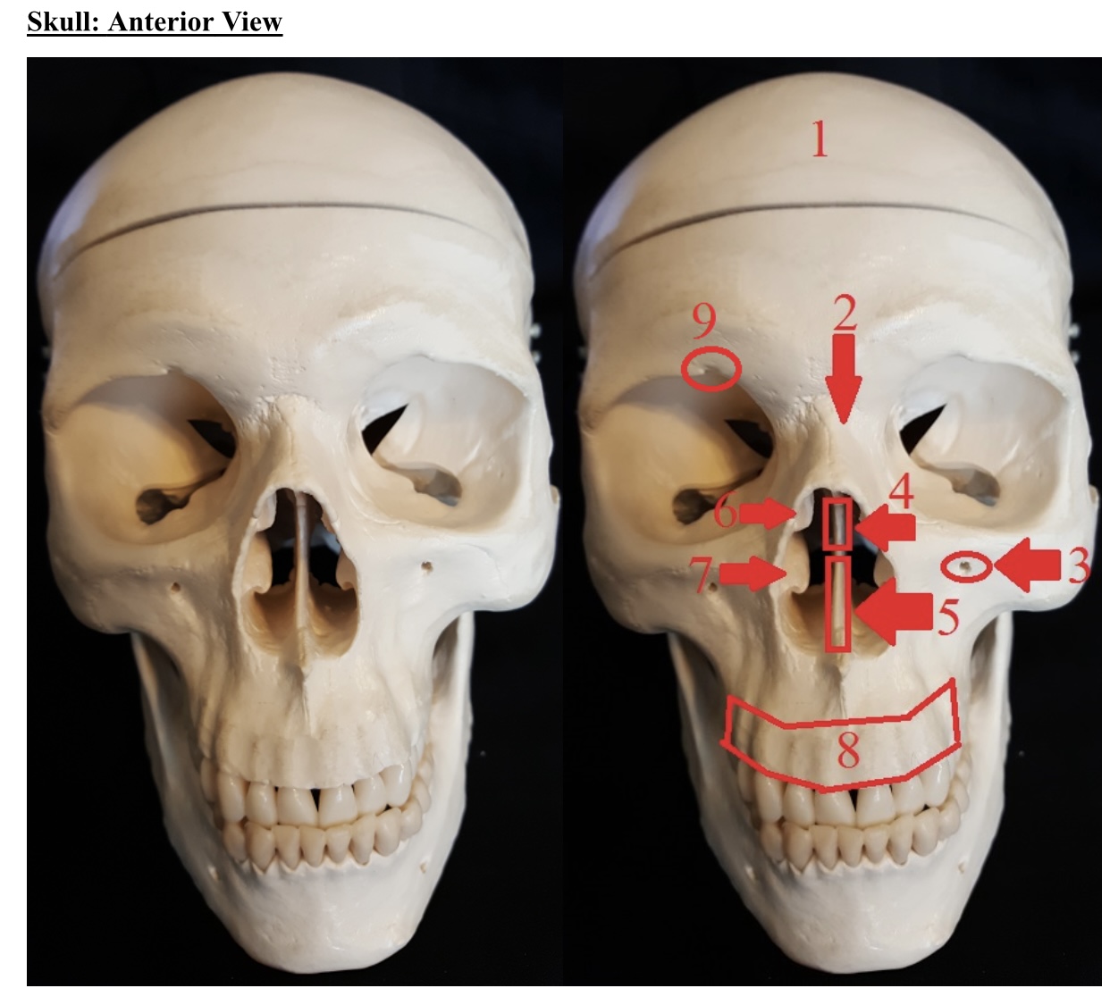 <p>2) name this bone</p>