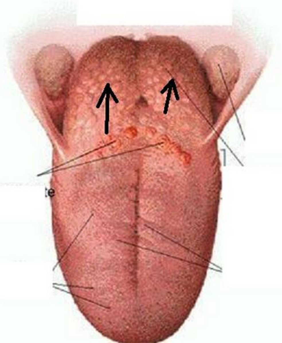 <p>located at the base of the tongue</p>