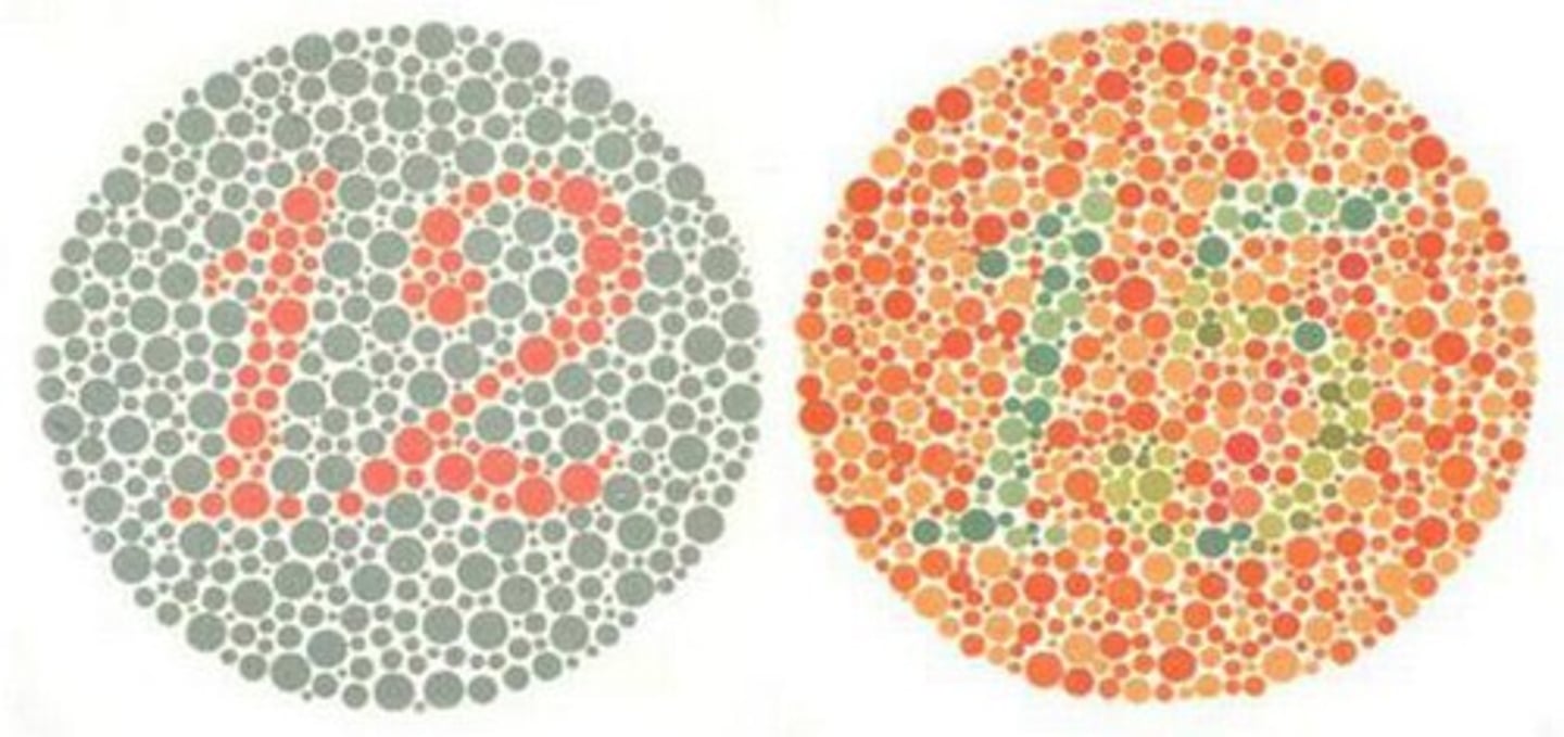 <p>X chromosome trait affecting color perception</p>