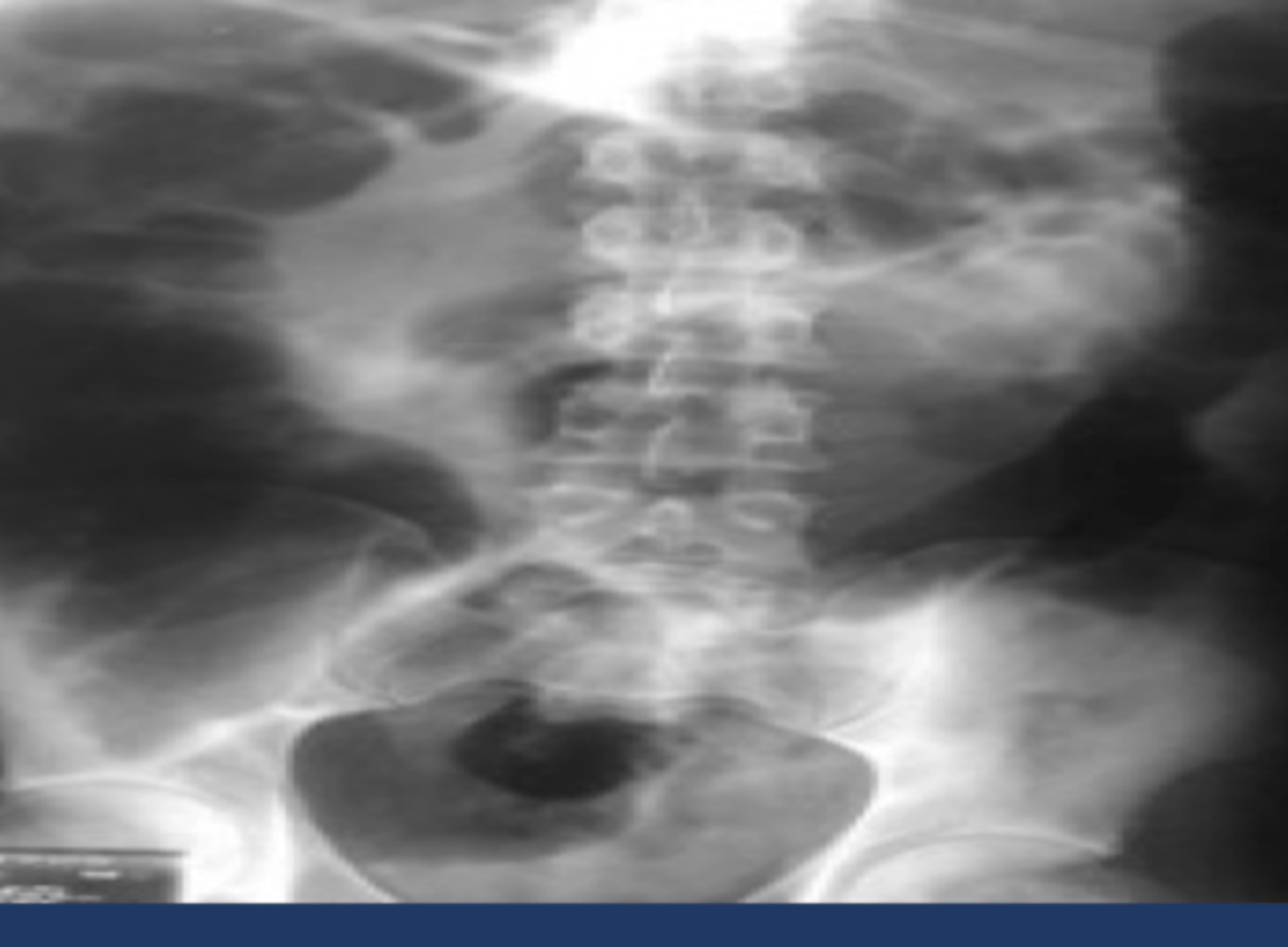 <p>identify what this is</p>