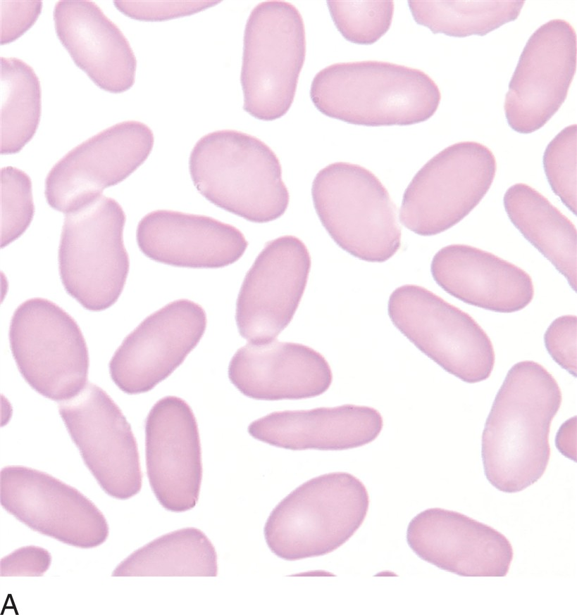 <p>what is an elliptocyte (pencil or cigar cells)?</p>