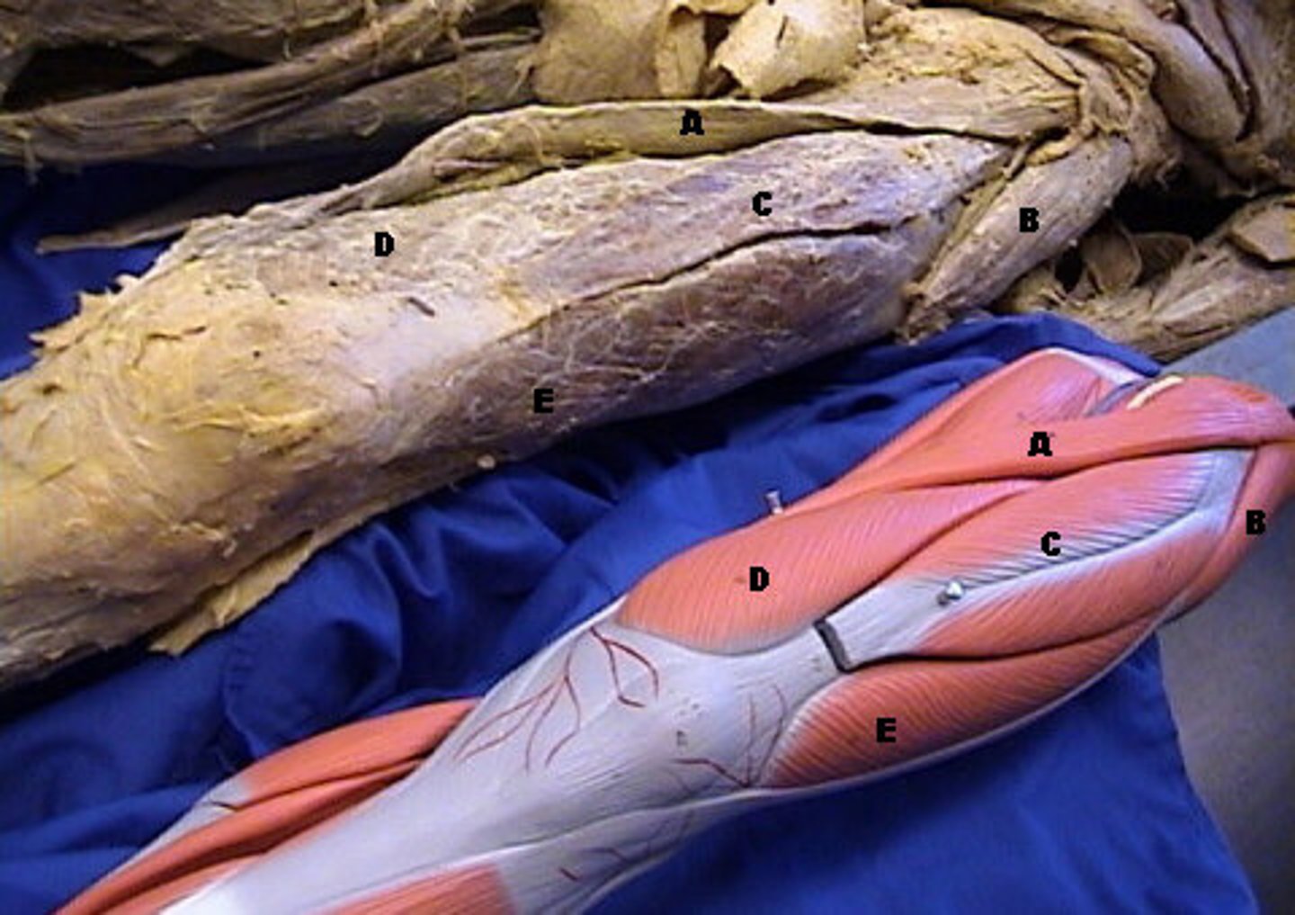 <p>B-, flexes/abducts/rotates thigh medially;, fan-shaped superficial thigh muscle attached to the ilioitibial band</p>