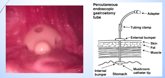 <p>Gastronomy placement </p>