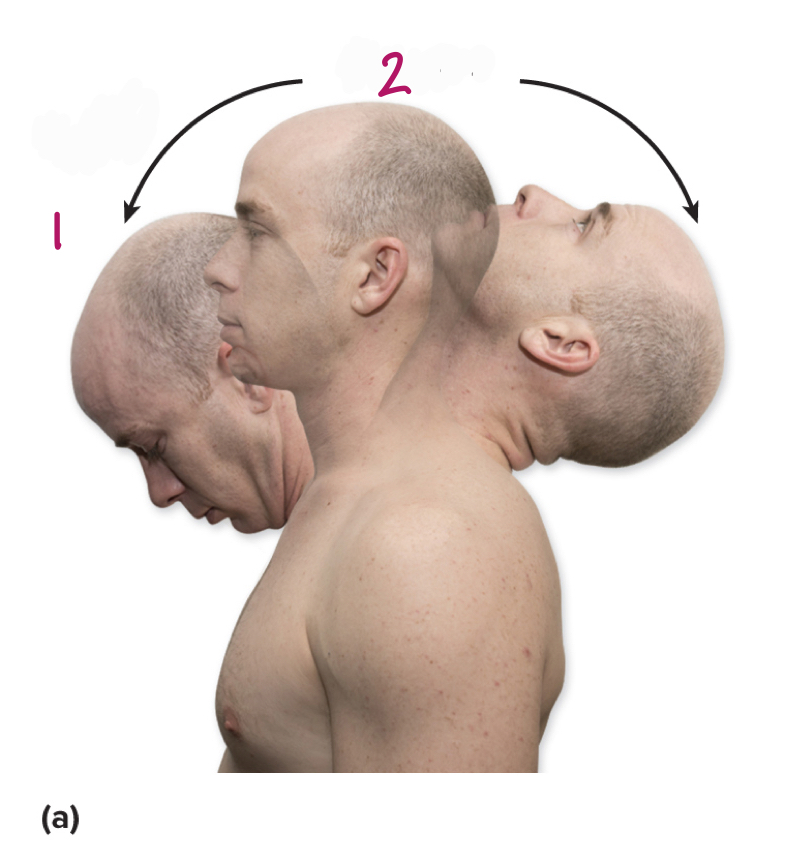 <p>Label figure 1.</p>