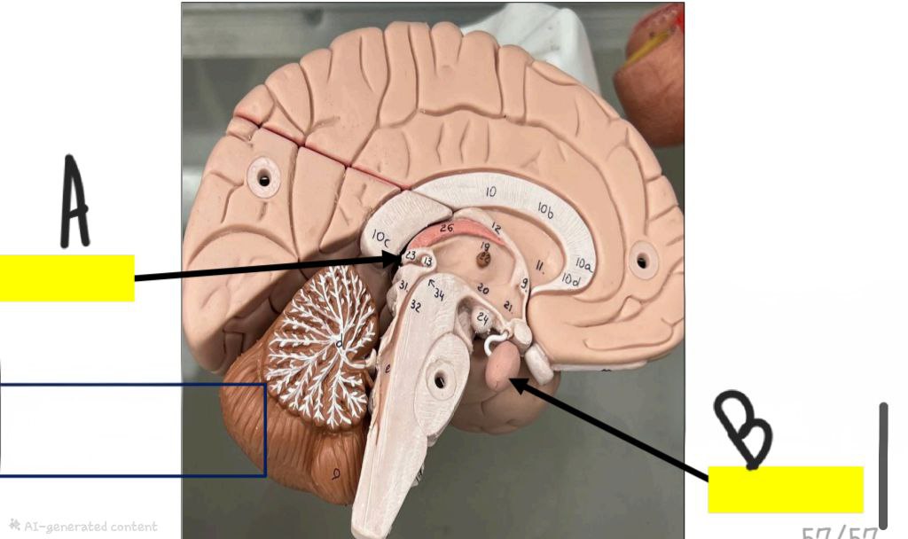 <p>Identify the glands in this picture and specify their secretions and site </p>