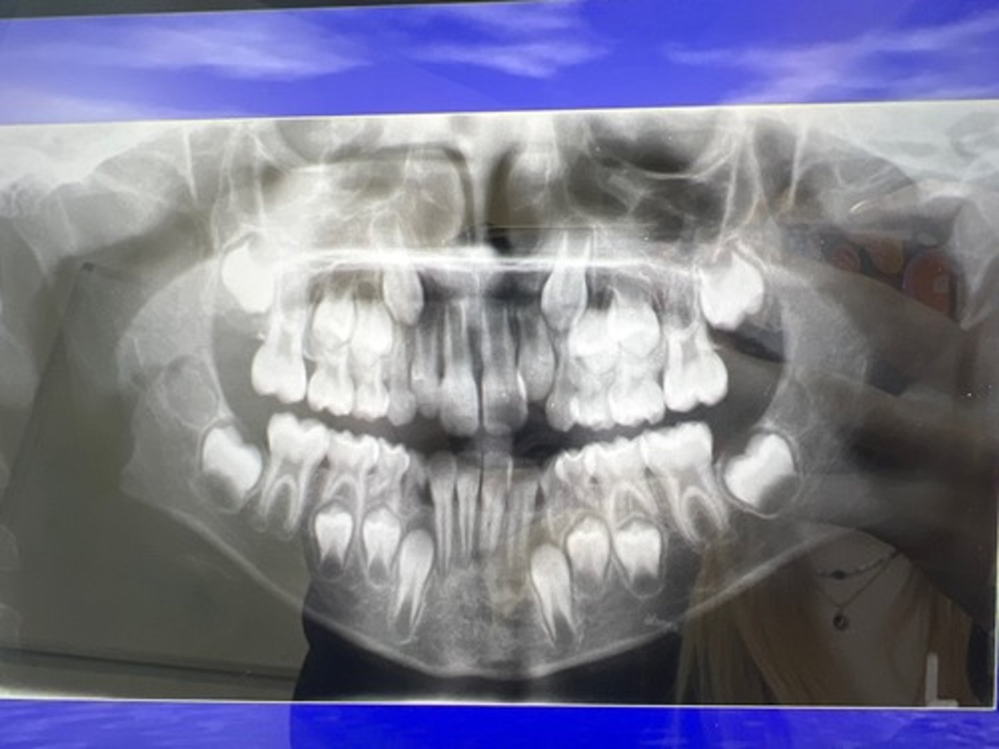 knowt flashcard image