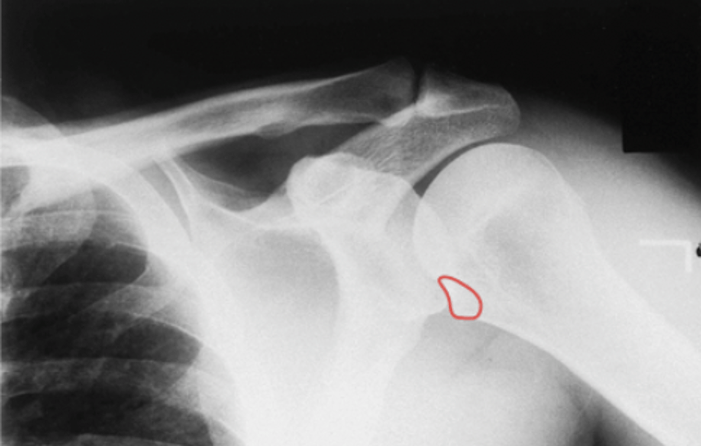 <p>What structure is highlighted?</p>