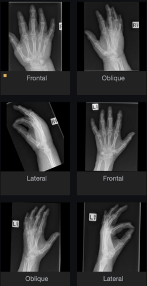 <p>Describe findings</p>