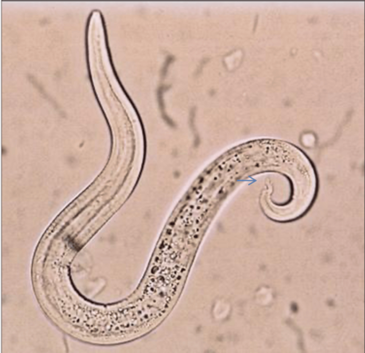 <p>Found in cat showing mild dyspnoea. What parasite is this?</p>