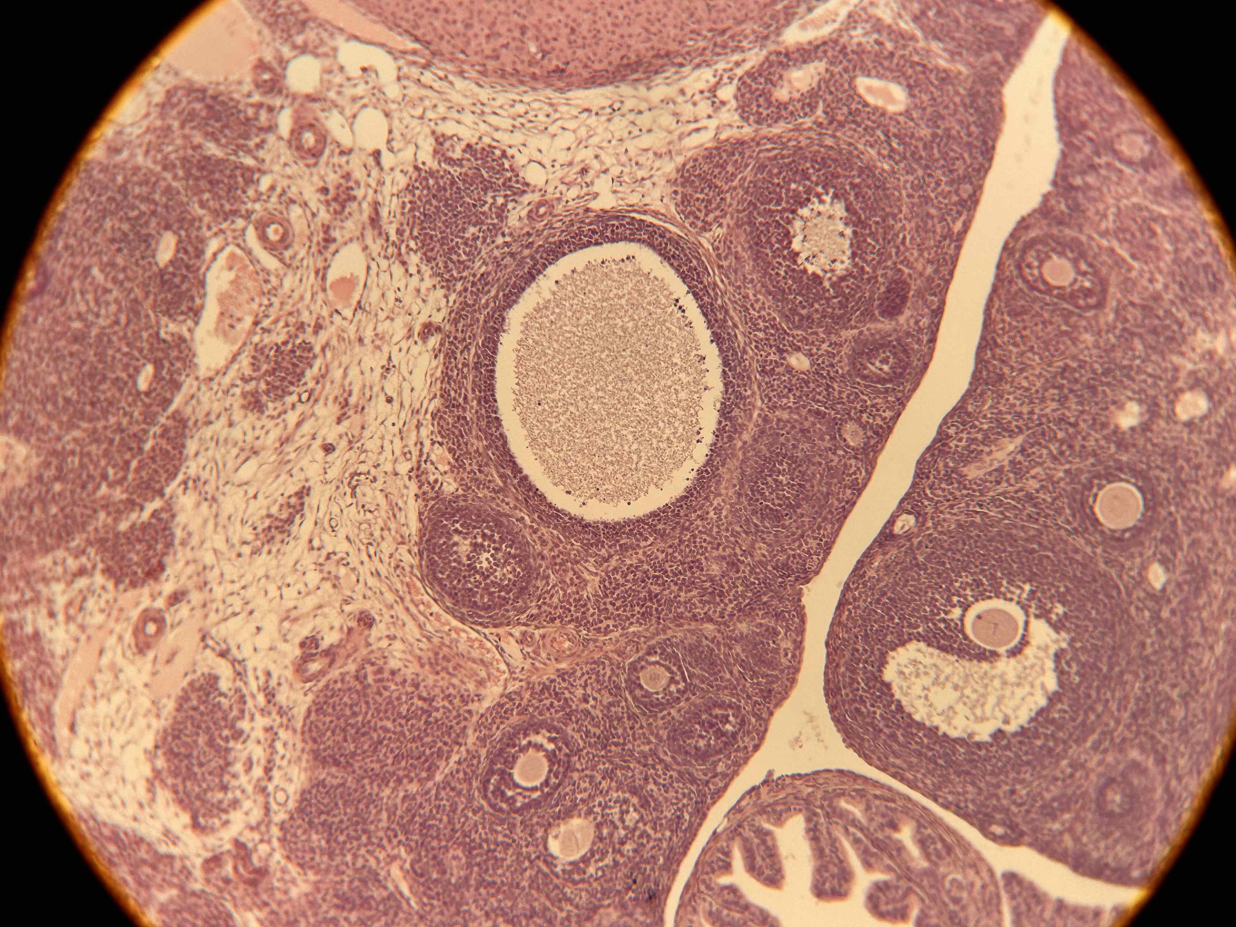 term image