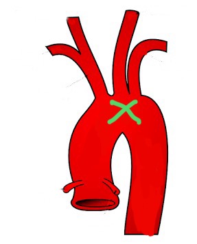 <p>Curved portion of aorta; gives branches to head, neck, and arms.</p>