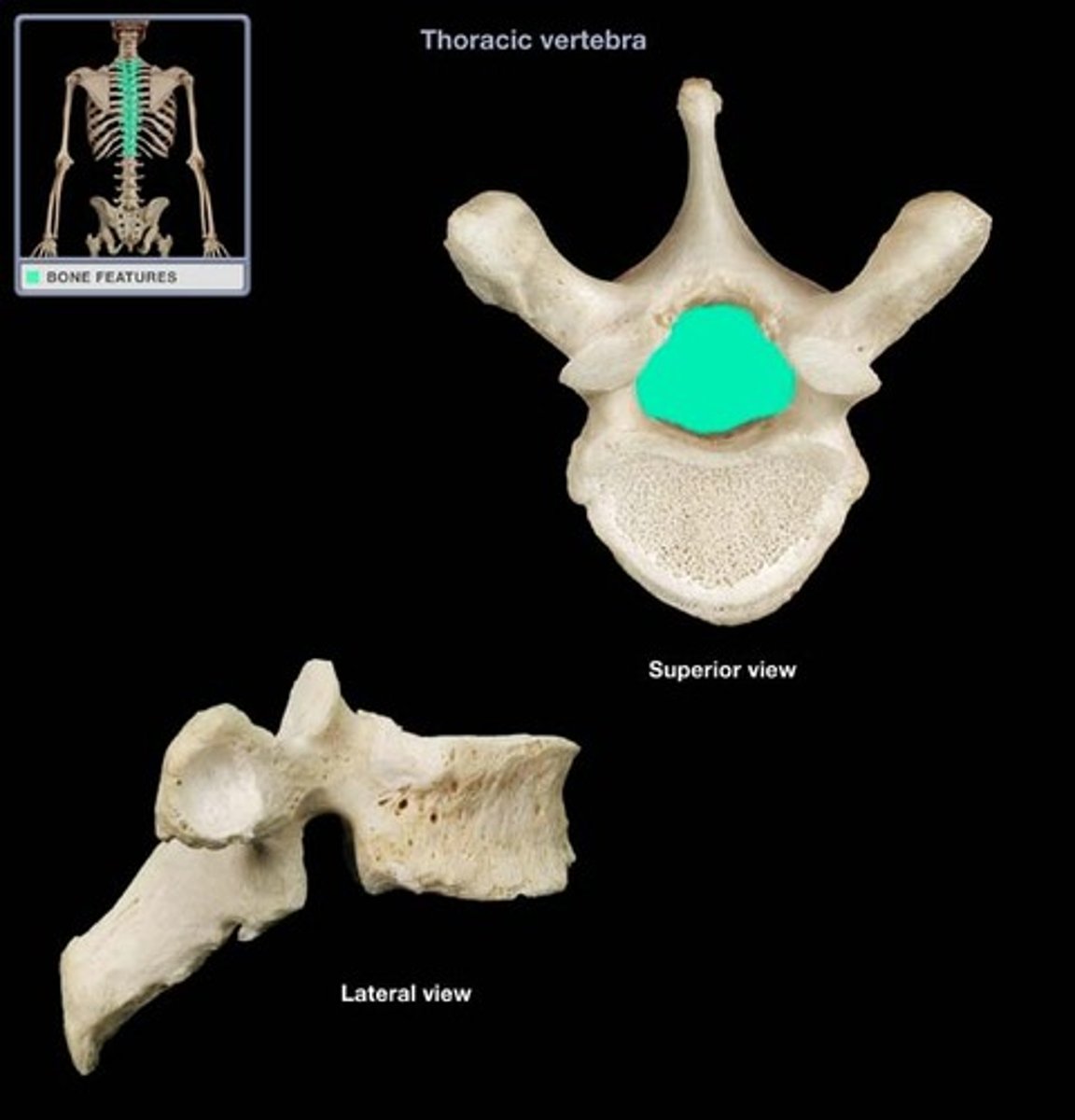 <p>opening posterior to vertebral body through which the spinal cord passes</p>