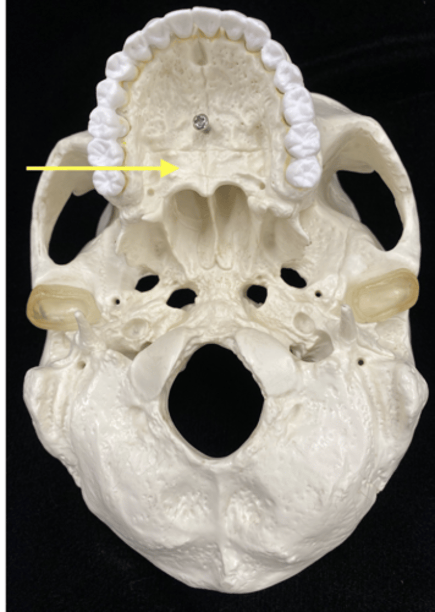 <p>name the bone and bone feature</p>